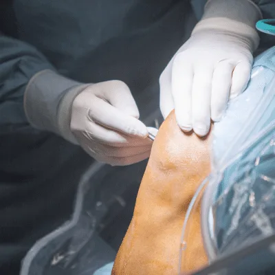 Especialista en el Diagnóstico y Tratamiento del Dolor de Hombro en Naucalpan de Juárez